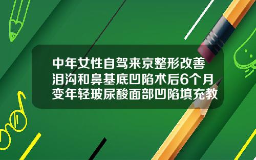 中年女性自驾来京整形改善泪沟和鼻基底凹陷术后6个月变年轻玻尿酸面部凹陷填充教学视频