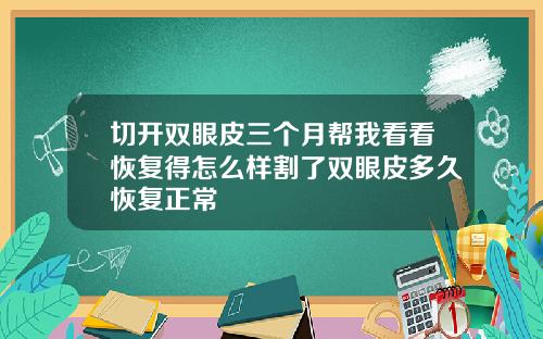 切开双眼皮三个月帮我看看恢复得怎么样割了双眼皮多久恢复正常