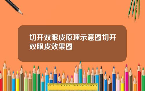 切开双眼皮原理示意图切开双眼皮效果图