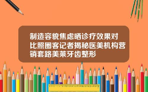 制造容貌焦虑晒诊疗效果对比照圈客记者揭秘医美机构营销套路美莱牙齿整形