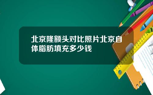 北京隆额头对比照片北京自体脂肪填充多少钱