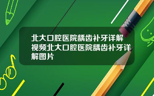 北大口腔医院龋齿补牙详解视频北大口腔医院龋齿补牙详解图片