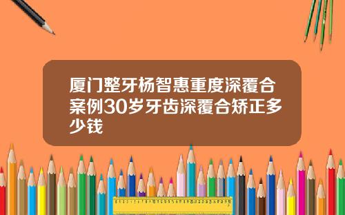 厦门整牙杨智惠重度深覆合案例30岁牙齿深覆合矫正多少钱