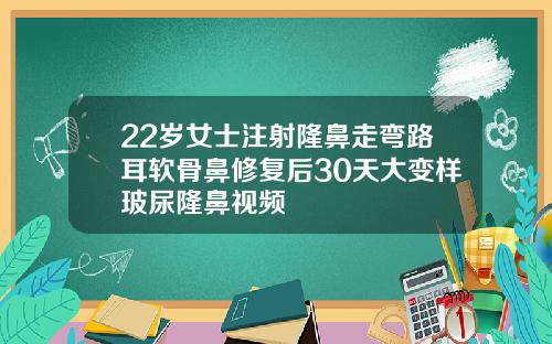 22岁女士注射隆鼻走弯路耳软骨鼻修复后30天大变样玻尿隆鼻视频