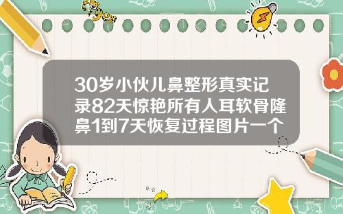 30岁小伙儿鼻整形真实记录82天惊艳所有人耳软骨隆鼻1到7天恢复过程图片一个人