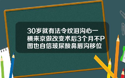 30岁就有法令纹泪沟心一横来京做改变术后3个月不P图也自信玻尿酸鼻唇沟移位