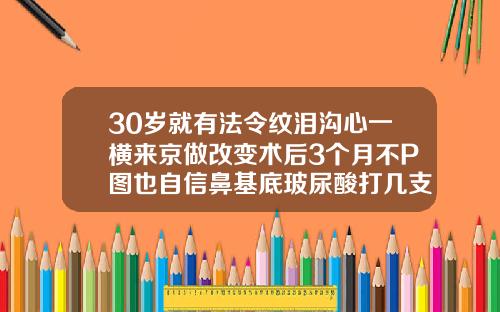 30岁就有法令纹泪沟心一横来京做改变术后3个月不P图也自信鼻基底玻尿酸打几支