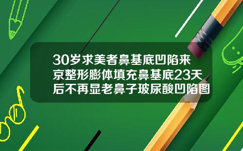 30岁求美者鼻基底凹陷来京整形膨体填充鼻基底23天后不再显老鼻子玻尿酸凹陷图片