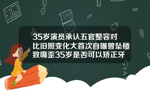 35岁演员承认五官整容对比旧照变化大首次自曝曾坠楼致嘴歪35岁是否可以矫正牙齿