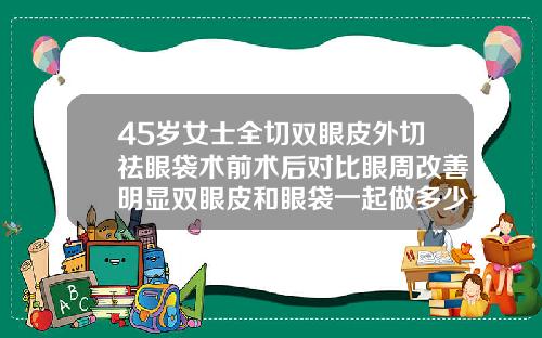 45岁女士全切双眼皮外切祛眼袋术前术后对比眼周改善明显双眼皮和眼袋一起做多少费用合适