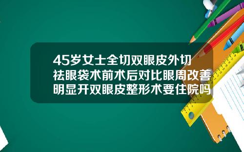 45岁女士全切双眼皮外切祛眼袋术前术后对比眼周改善明显开双眼皮整形术要住院吗